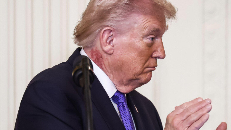 foto donald trump a fost supus celui de al treilea control medical in 13 luni ce a declarat presedintele sua care face 80 de ani in iunie 6a15ec8ce2d95