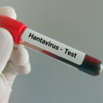 suspiciune de infectie cu hantavirus in cazul unui pompier de la isu caras severin barbatul ar fi calatorit in serbia 6a0f4917925e3