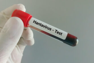 suspiciune de infectie cu hantavirus in cazul unui pompier de la isu caras severin barbatul ar fi calatorit in serbia 6a0f4917925e3