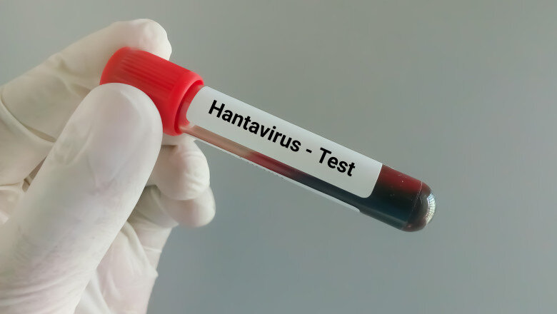 suspiciune de infectie cu hantavirus in cazul unui pompier de la isu caras severin barbatul ar fi calatorit in serbia 6a0f4917925e3
