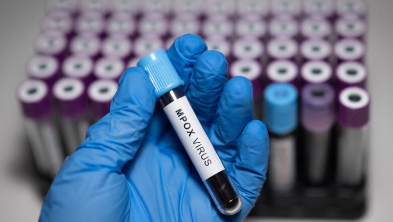 doi oameni de stiinta acuzati ca au adus ilegal in sua fiole cu virus mpox dezactivat din africa si au mintit autoritatile 6a214b7a683fb