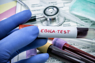 virusul ebola poate ramane ascuns in organism luni sau ani cum poate reaparea infectia studiu 6a366d0986e5d