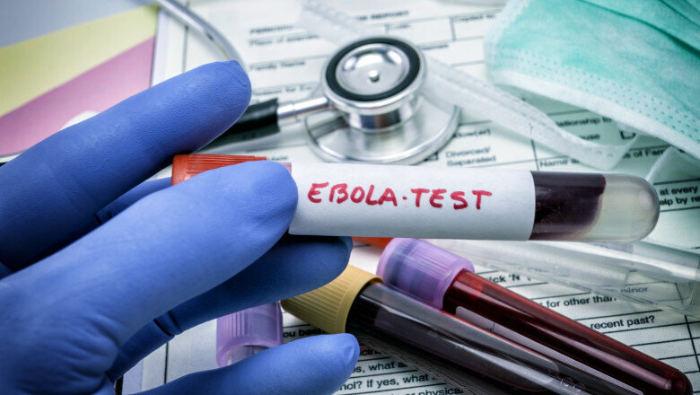 virusul ebola poate ramane ascuns in organism luni sau ani cum poate reaparea infectia studiu 6a366d0986e5d