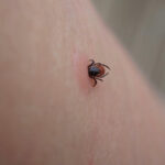 ue evalueaza un vaccin pfizer impotriva bolii lyme infectie transmisa prin muscatura de capusa 6a812cba8b926
