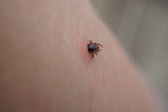 ue evalueaza un vaccin pfizer impotriva bolii lyme infectie transmisa prin muscatura de capusa 6a812cba8b926